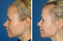 Before & After Photos